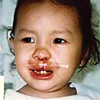 Alia nachher, Operation Restore Hope