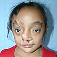 Charlene vorher, Operation Restore Hope