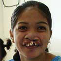 Corazon vorher, Operation Restore Hope